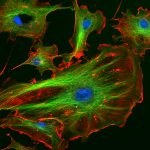 Análise e processamento de imagens em microscopia de fluorescência